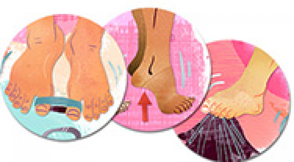 Så fixar du fothälsan